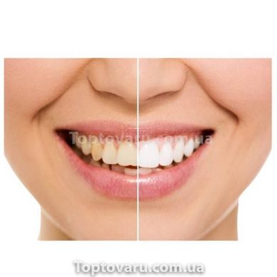 Ультразвуковая зубная щетка Medica+ Probrush 9.0 (Япония) Белая 50106 18451 фото
