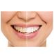 Ультразвуковая зубная щетка Medica+ Probrush 9.0 (Япония) Белая 50106 18451 фото 5