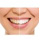 Звуковая зубная щетка Medica+ ProBrush 7.0 Compact (Япония) Серебро 50996/2 18429 фото 6