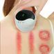 Массажер антицелюлитный для тела Cupping AND LY-873 Белый 26678 фото 6